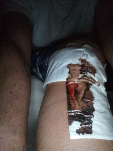 16159497083371727127623