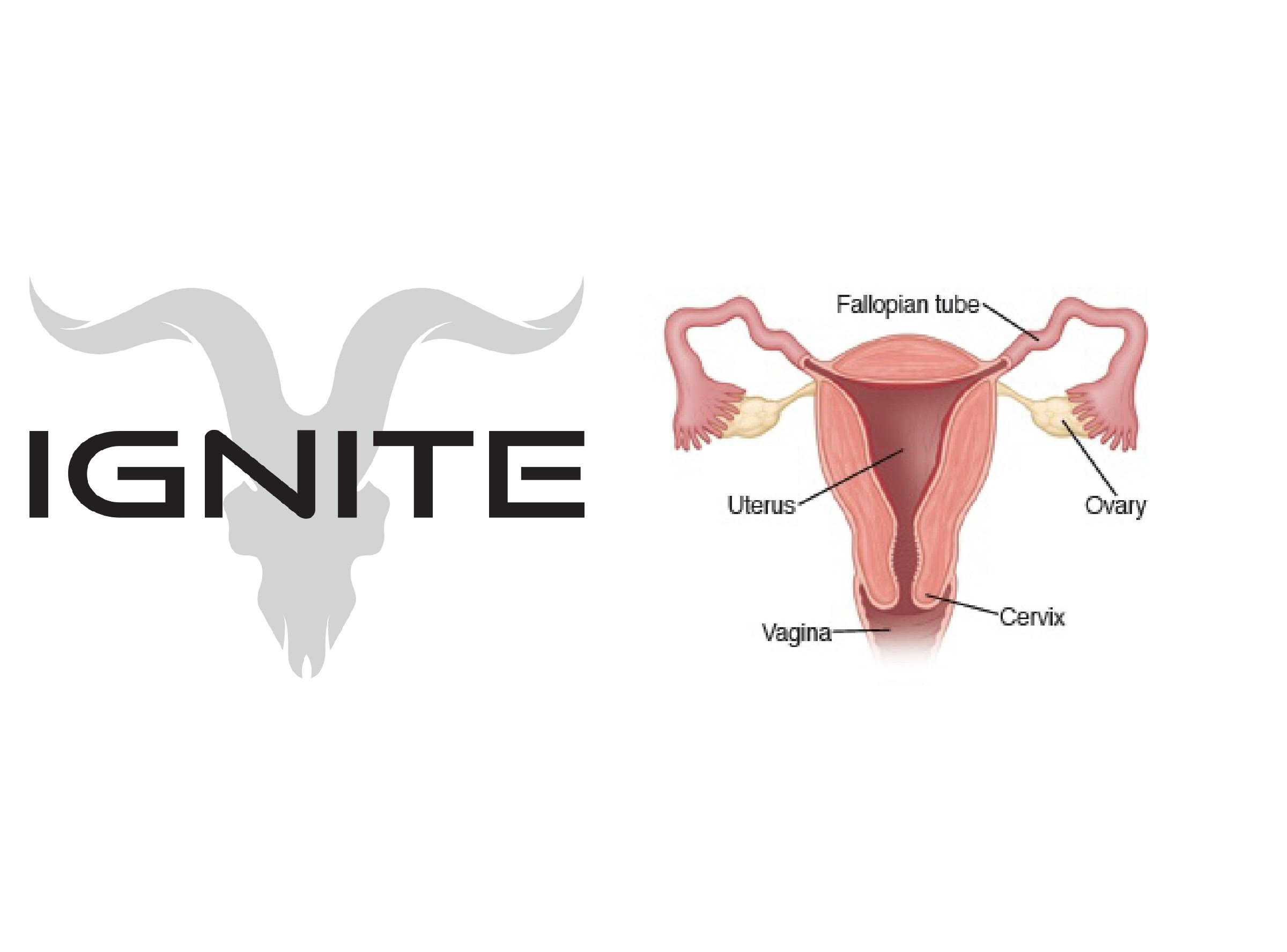 Vagina Vape
